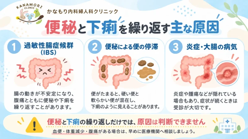 便秘と下痢を繰り返す原因として過敏性腸症候群、便の停滞、腸の炎症や腫瘍などを比較した図解