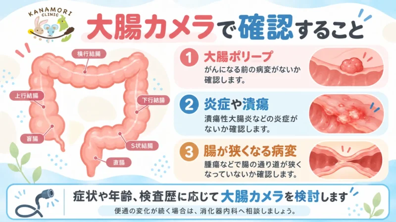 大腸カメラで確認できる大腸ポリープ、大腸の炎症や潰瘍、腸の狭窄を大腸の図で説明した画像